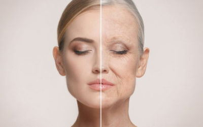 6 Tips para prevenir las arrugas prematuras